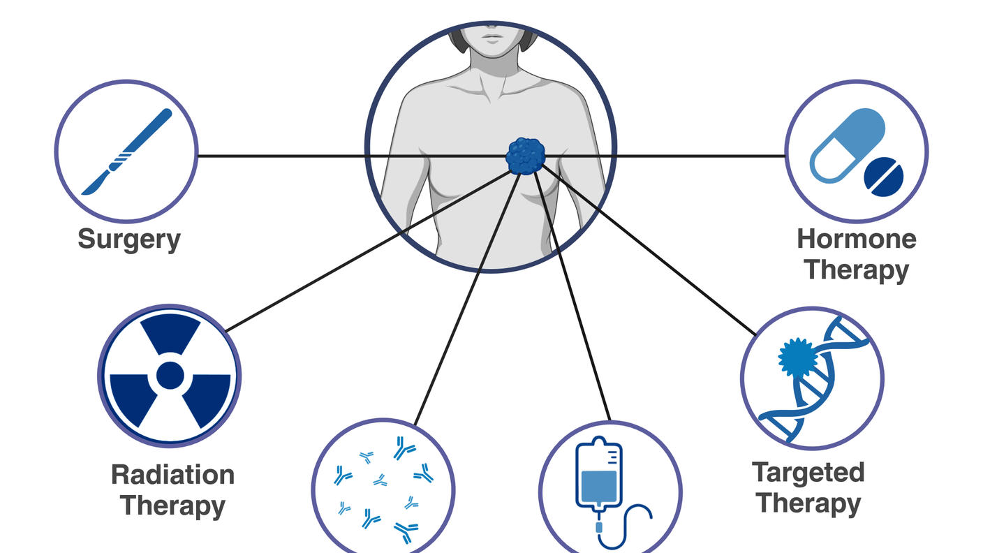 Drawing of a person with a tumor shown in their breast who is surrounded by icons representing different treatments, including chemotherapy, surgery, radiation therapy, immunotherapy, targeted therapy, and hormone therapy.