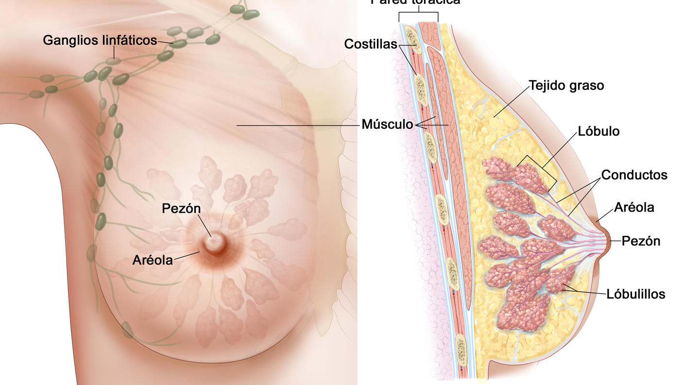 En el dibujo se observa la anatomía de la mama femenina. A la izquierda, en una vista frontal, se señalan los ganglios linfáticos que van desde la mama hasta la axila. A la derecha, en una vista lateral, se señalan la pared torácica, las costillas, el tejido graso, los lóbulos, los conductos y los lobulillos. Además, en ambas vistas se observa el músculo, el pezón y la aréola.