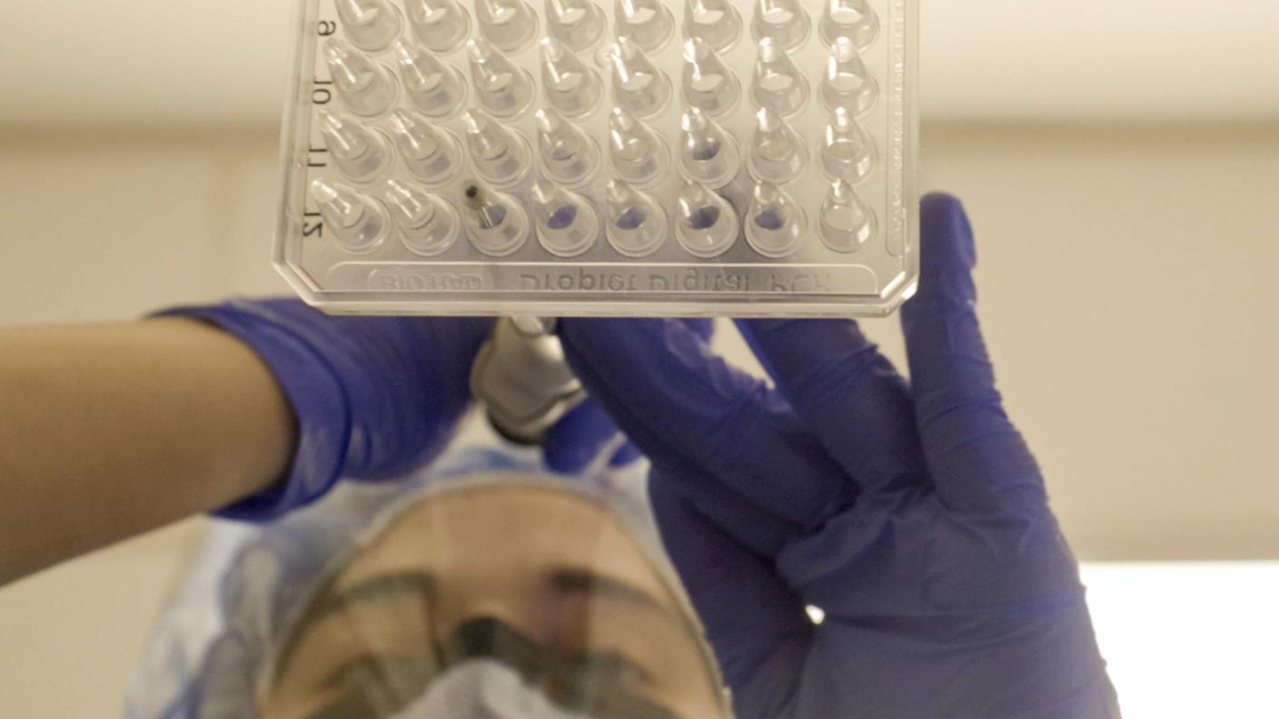 A picture from below of a lab tech wearing a mask, safety glasses, and blue gloves dropping materials from a pipette into a 64-well plate.