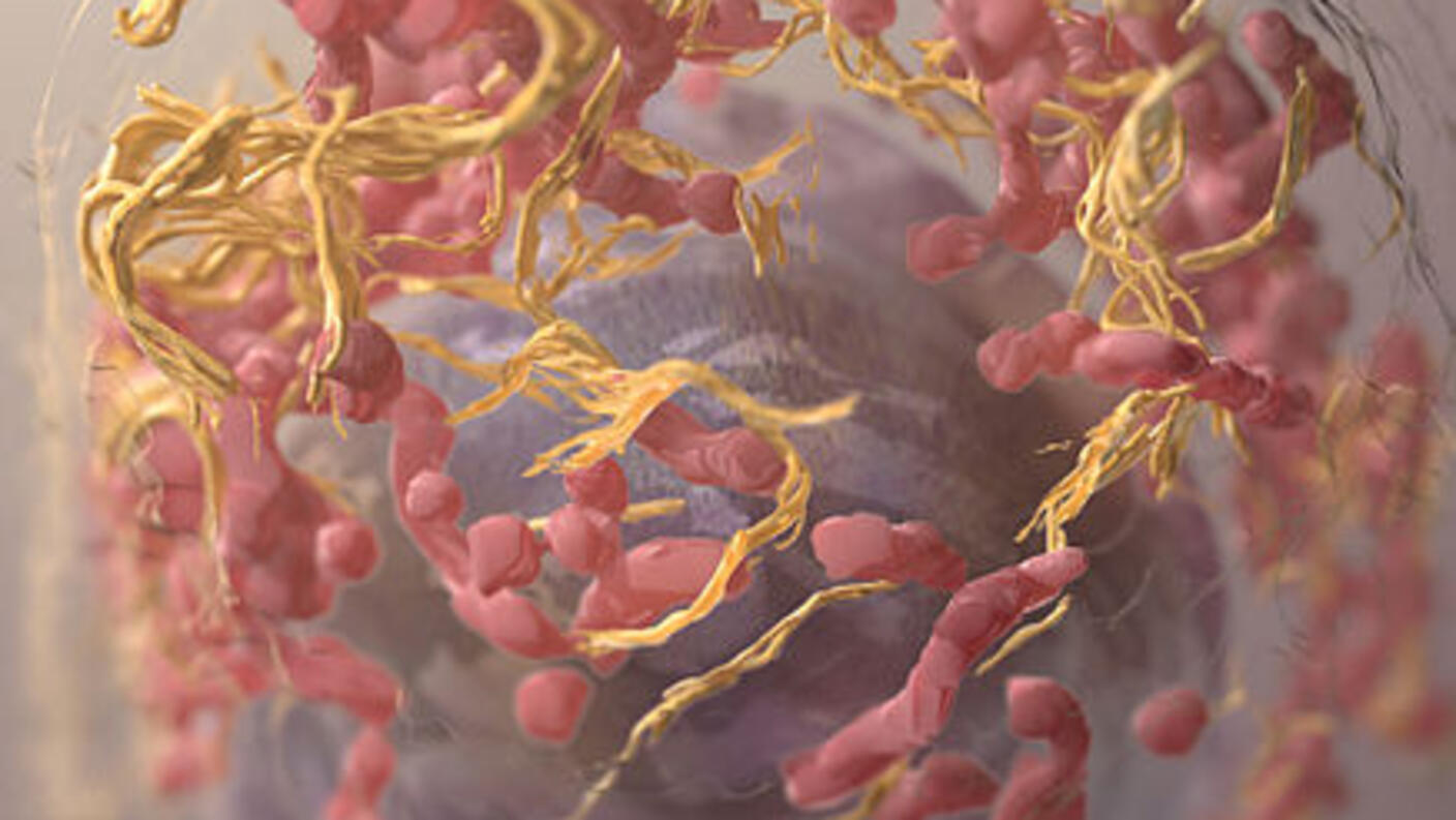 Three-dimensional structure of a melanoma cell.
