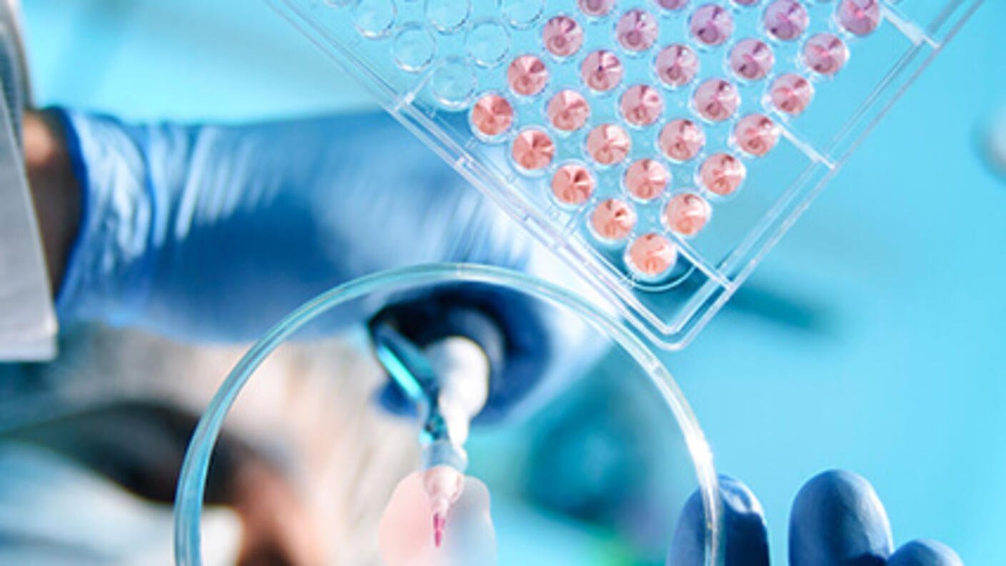A lab technician hands using a pipette and petri dish.