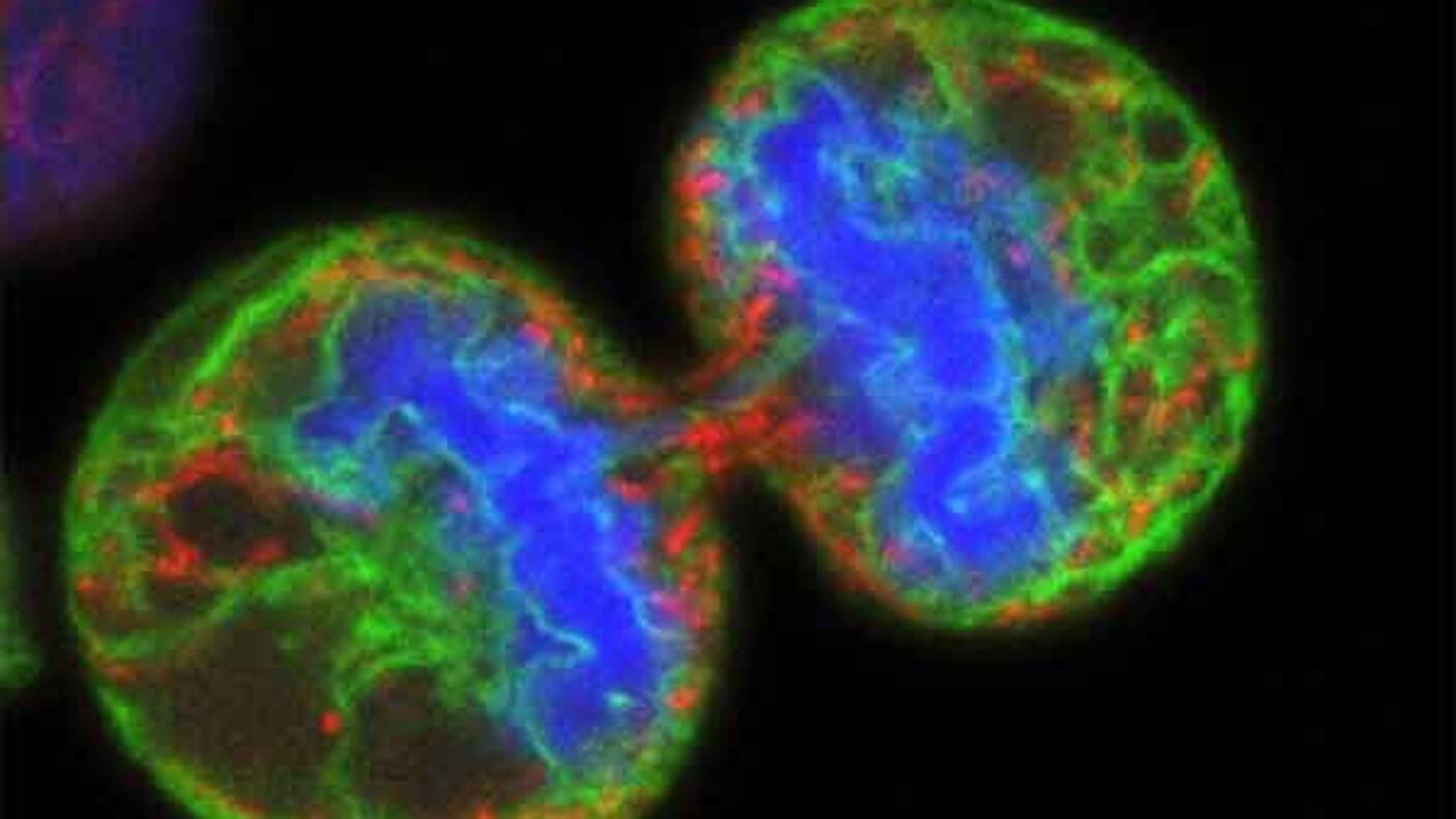 Microscope image showing two dividing melanoma cancer cells in vibrant colors - blue centers surrounded by green and red patterns - being targeted by T-VEC oncolytic virus therapy.