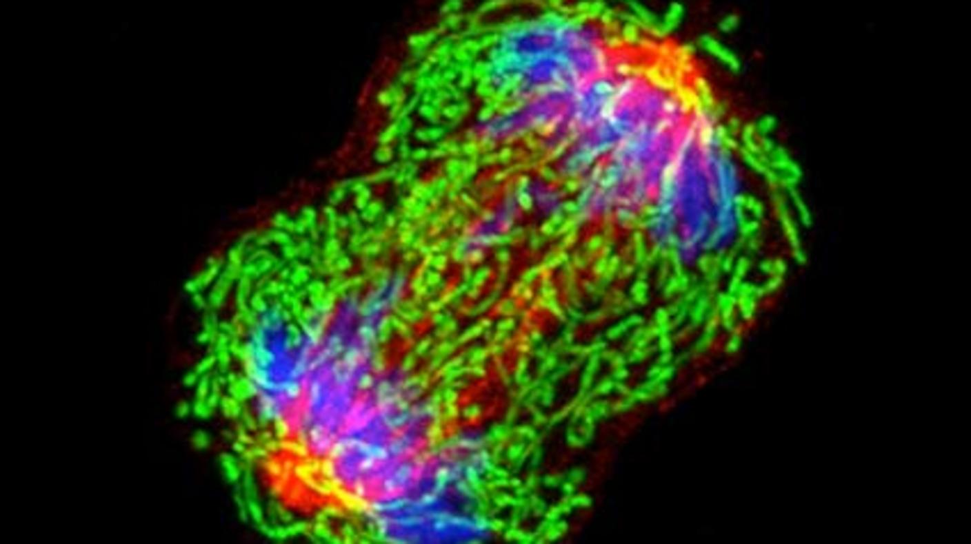 Una célula de cáncer de seno (mama) que se multiplica.