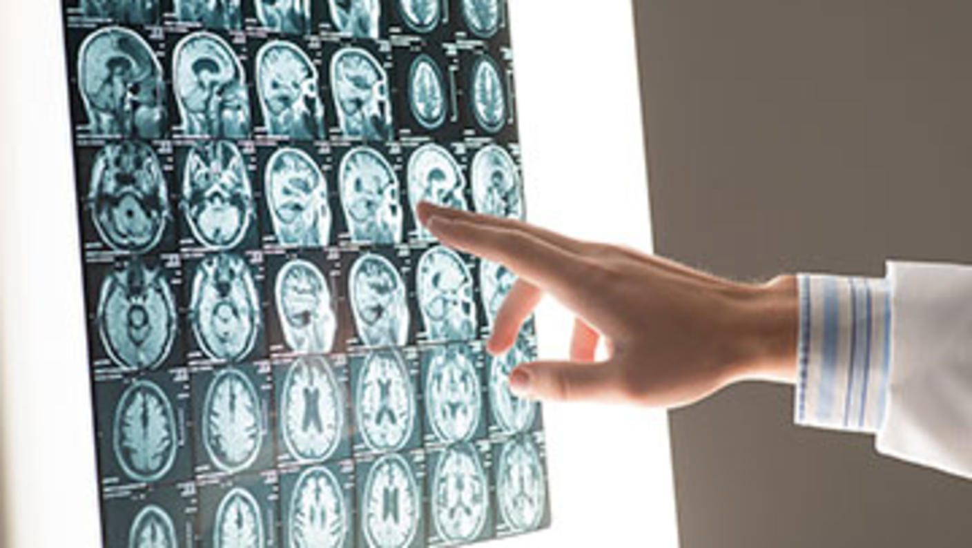 Series of brain scan images on a lightbox