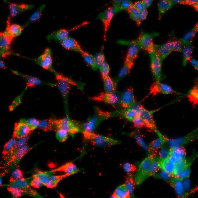 Prostate cancer cells interacting with polymeric nanoparticles coated with targeting molecules.