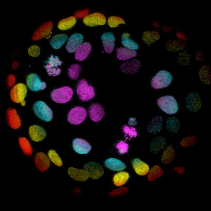 Colorectal cancer cells stained different colors, against a black background